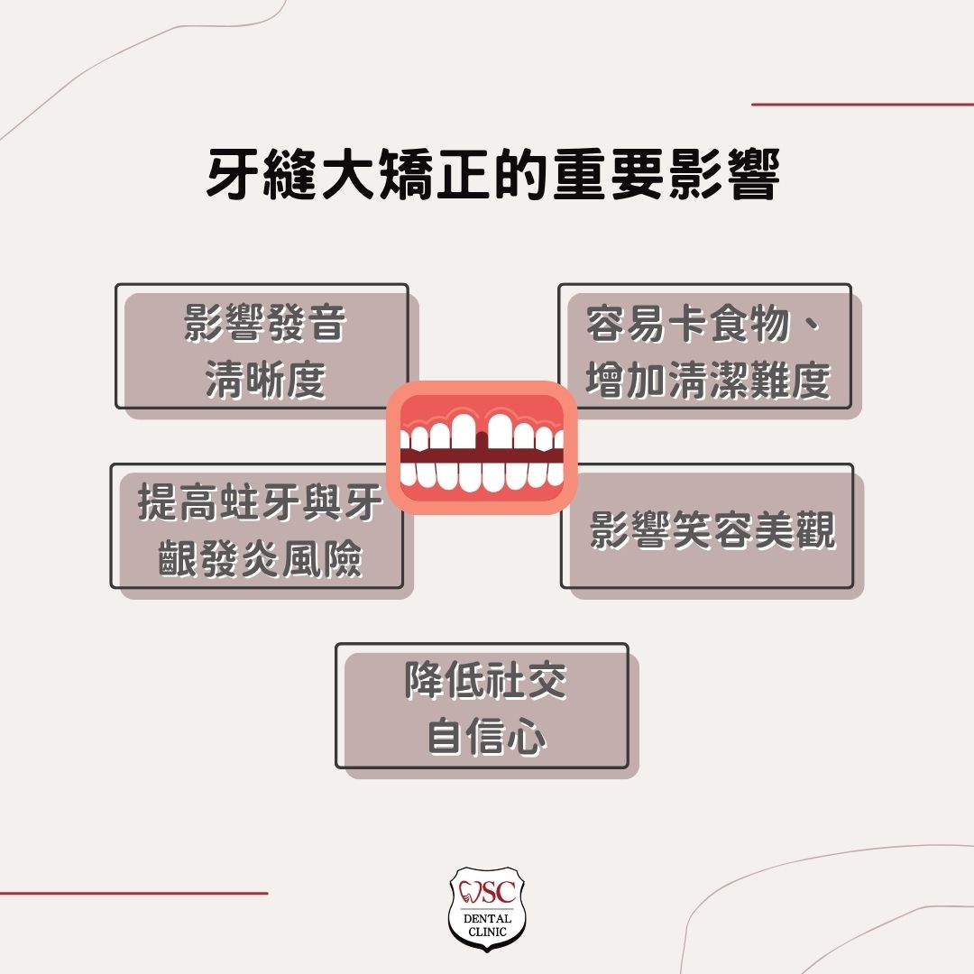 牙縫大矯正dcard熱烈討論!門牙縫大矯正方法有哪些?專家詳解療程與費用關鍵 1 牙縫大矯正的重要影響