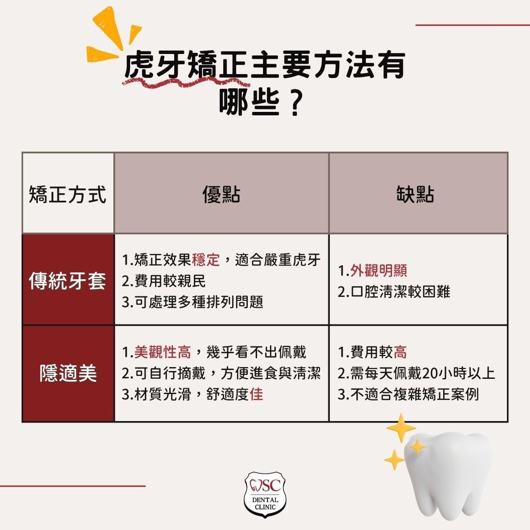 笑起來虎牙很突出嗎?虎牙矯正必要嗎?醫:先知道這2種虎牙矯正方式 2 虎牙矯正方法
