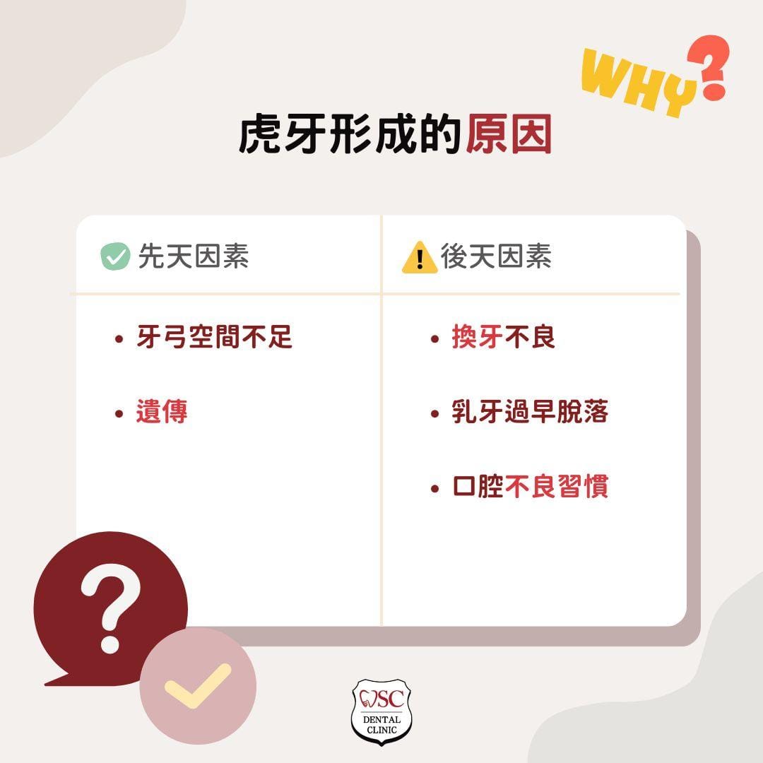 笑起來虎牙很突出嗎?虎牙矯正必要嗎?醫:先知道這2種虎牙矯正方式 1 虎牙形成原因