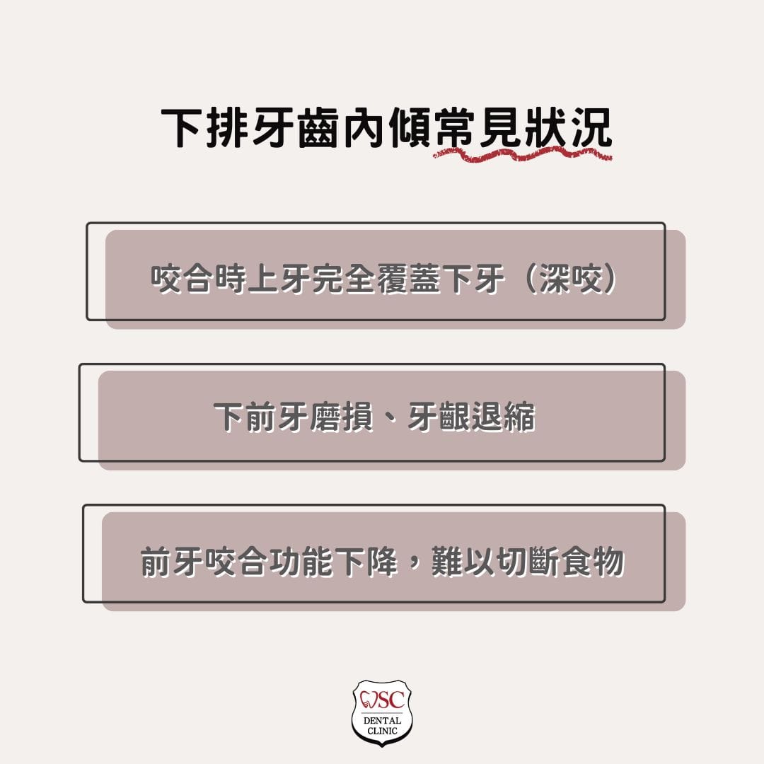下排牙齒內傾常見狀況