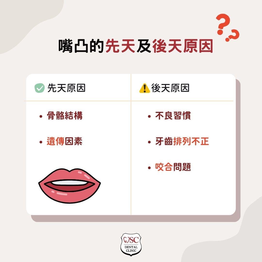 嘴凸困擾著你嗎?專業醫師說明嘴凸矯正方法,助你找回自信笑容! 1 嘴凸的先天及後天原因