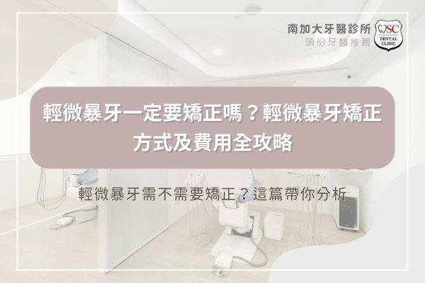輕微暴牙一定要矯正嗎？輕微暴牙矯正方式及費用全攻略