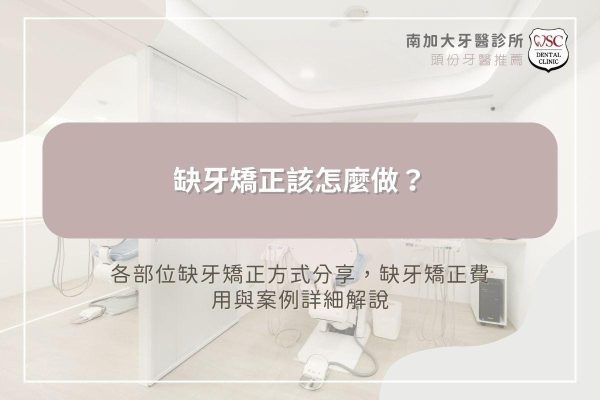 缺牙矯正該怎麼做？各部位缺牙矯正方式分享，缺牙矯正費用與案例詳細解說