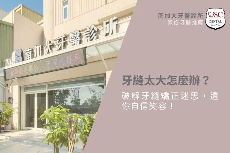 牙縫太大怎麼辦?破解牙縫矯正迷思,還你自信笑容! 4 牙縫太大怎麼辦?破解牙縫矯正迷思,還你自信笑容!