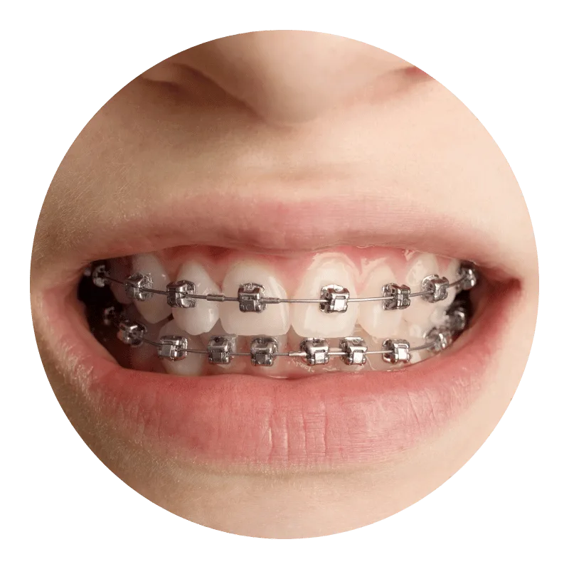 orthodontics 2