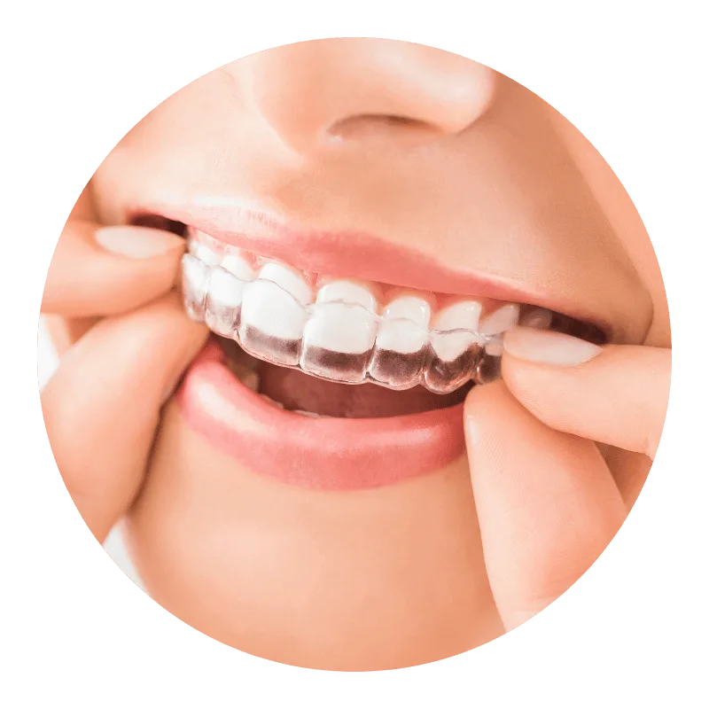 orthodontics 3