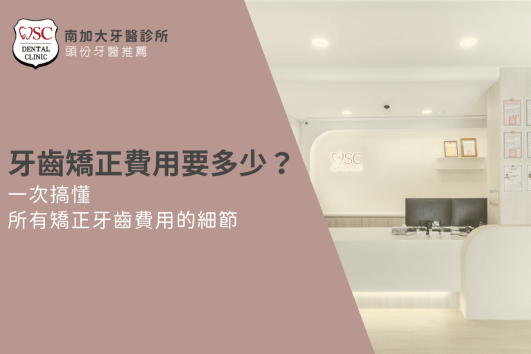 牙齒矯正費用要多少?一次搞懂所有矯正牙齒費用的細節 7 orthodontics guide 3