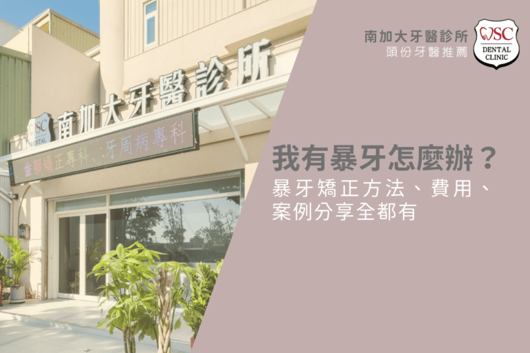 我有暴牙怎麼辦?暴牙矯正方法、費用、案例分享全都有 2 orthodontics guide 7