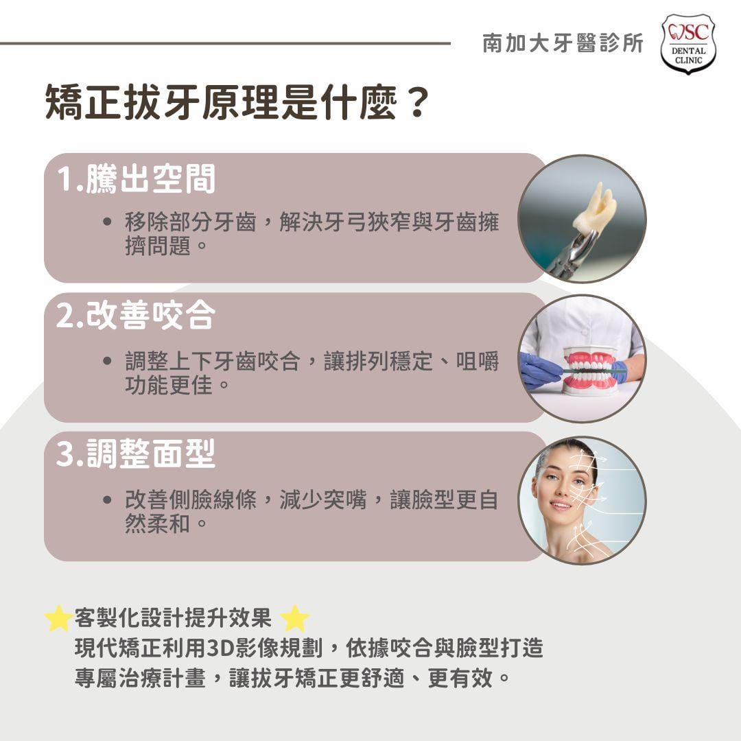 矯正拔牙是必要的嗎?矯正拔牙大小事一次告訴你 7 矯正拔牙原理是什麼?