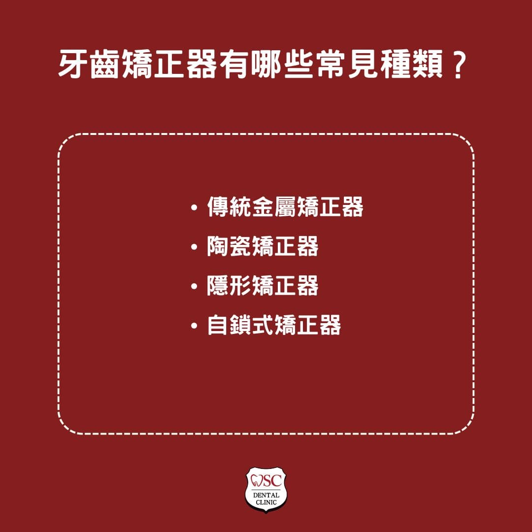 牙齒矯正器全方位指南,從種類到適用情況,找到最適合您的牙齒矯正方案 1 牙齒矯正器有哪些常見種類