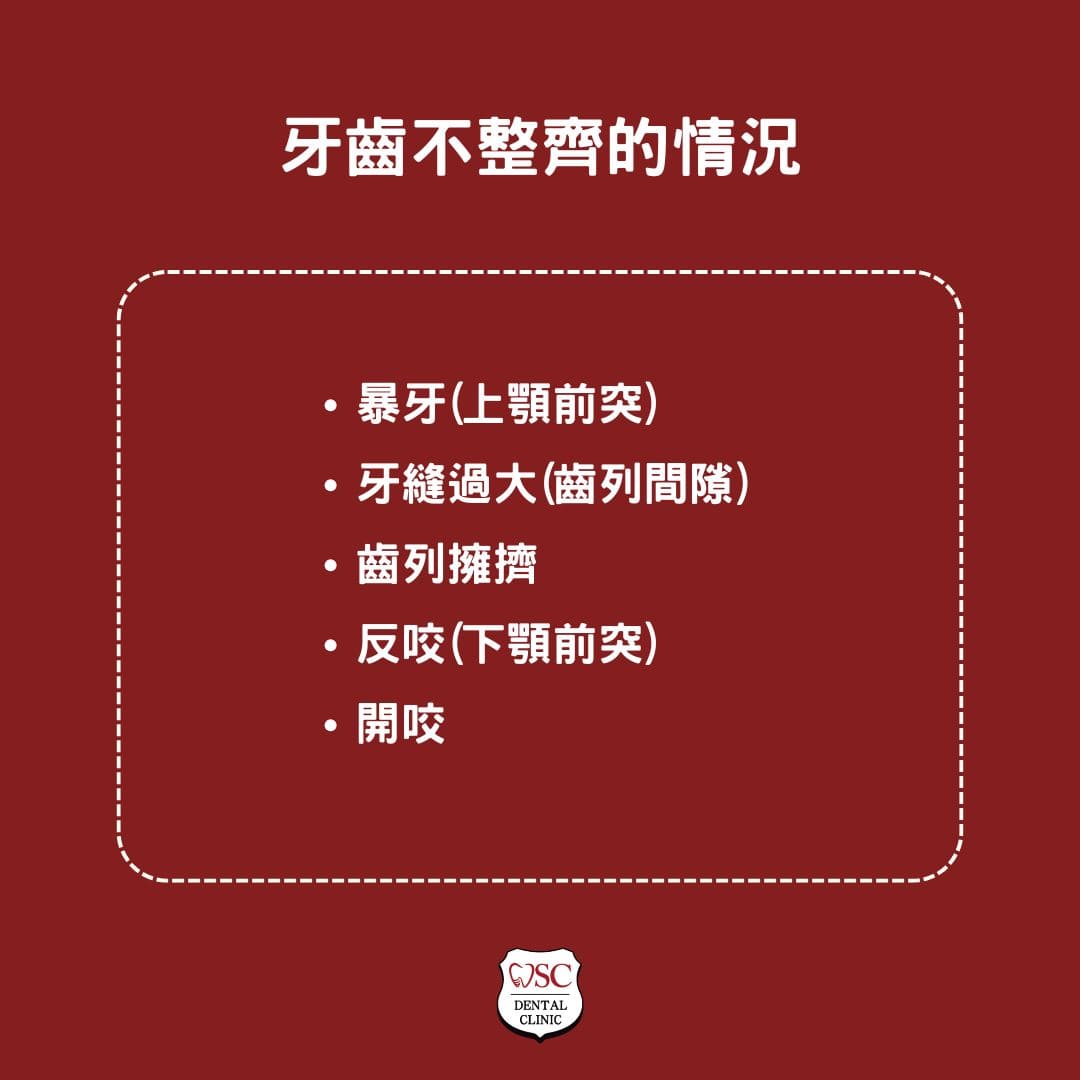 牙齒矯正器全方位指南,從種類到適用情況,找到最適合您的牙齒矯正方案 2 牙齒不整齊的情況