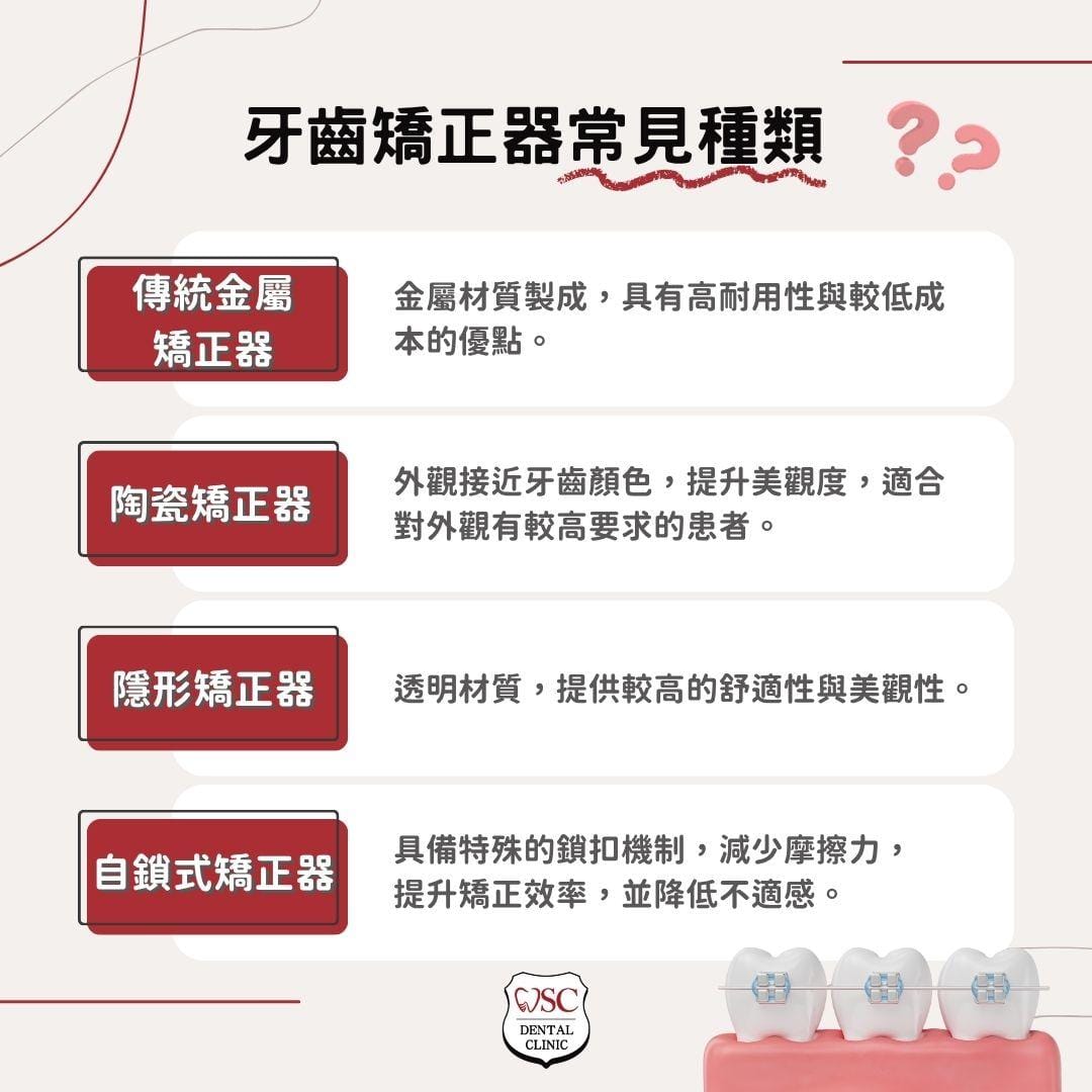 牙齒矯正器全方位指南,從種類到適用情況,找到最適合您的牙齒矯正方案 1 牙齒矯正器有哪些常見種類