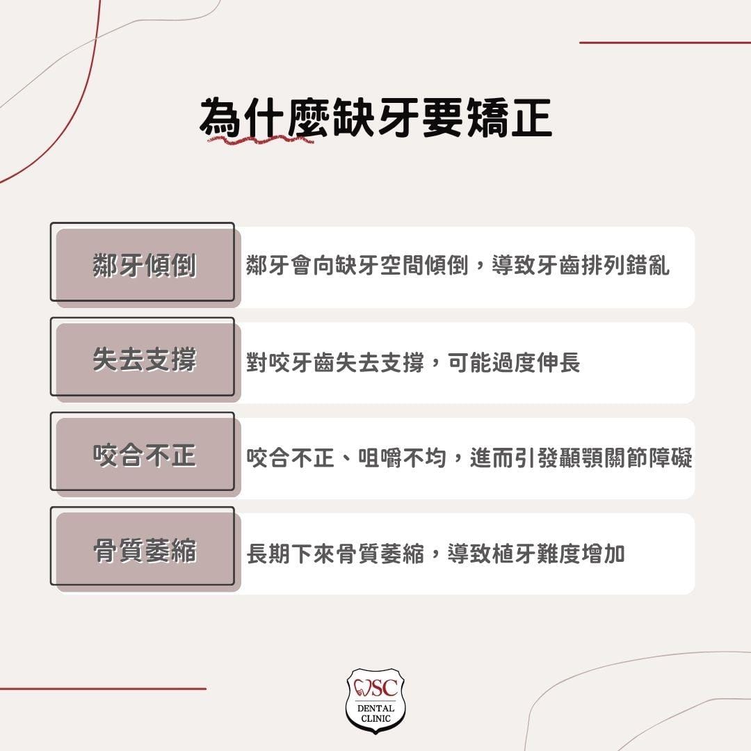 缺牙矯正該怎麼做?各部位缺牙矯正方式分享,缺牙矯正費用與案例詳細解說 1 為什麼缺牙要矯正